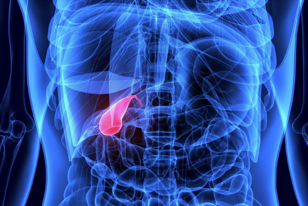 Gallbladder Cancer