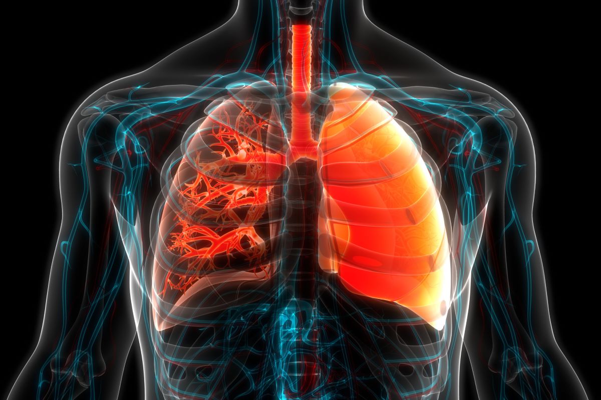 Pulmonary fibrosis