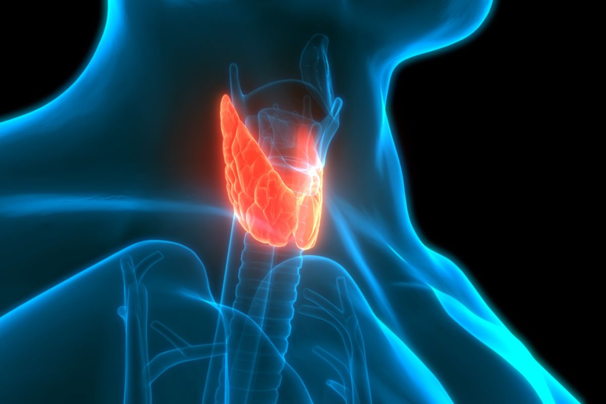 Thyroid cancer