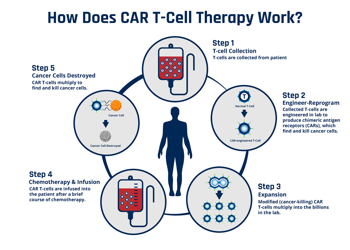 CAR T-cell infographic