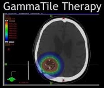 GammaTile Therapy