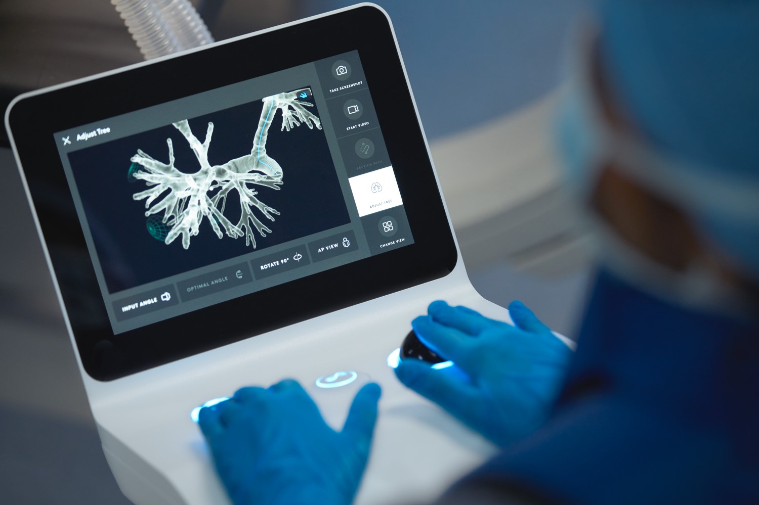 ion bronchoscopy controller